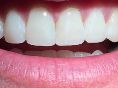 Tinka Smile - Cabinet stomatologic